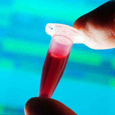 FDA অনুমোদিত টেস্টিং ল্যাবরেটরিজ দ্রুত সনাক্তকরণ খাদ্য যোগাযোগ বেবি বোতল তৃতীয় পক্ষের প্রমাণীকরণ পরিষেবা